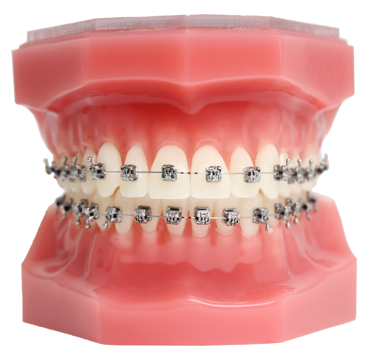 Pitts 21™ Greiner Orthodontics
